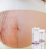 MaterniCream - Crème Maternité de Réparation Post-Grossesse - Prévention Anti-Vergetures Crème Maternité et Grossesse - Prévention Anti-Vergetures - Parents Sereins